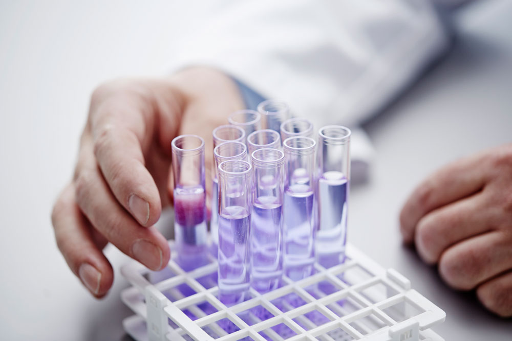 Laboratory test tubes